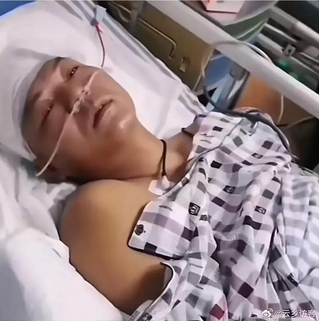 百万粉丝网红脑溢血昏迷离世，令人痛心的网络悲剧